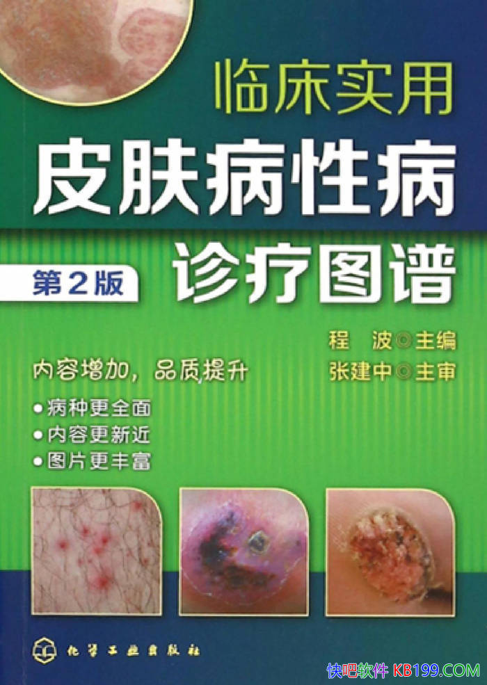 ���ٴ�ʵ��Ƥ�����Բ�����ͼ�� (��2��) ���̲�/ҽѧ/epub+mobi+azw3+pdf 